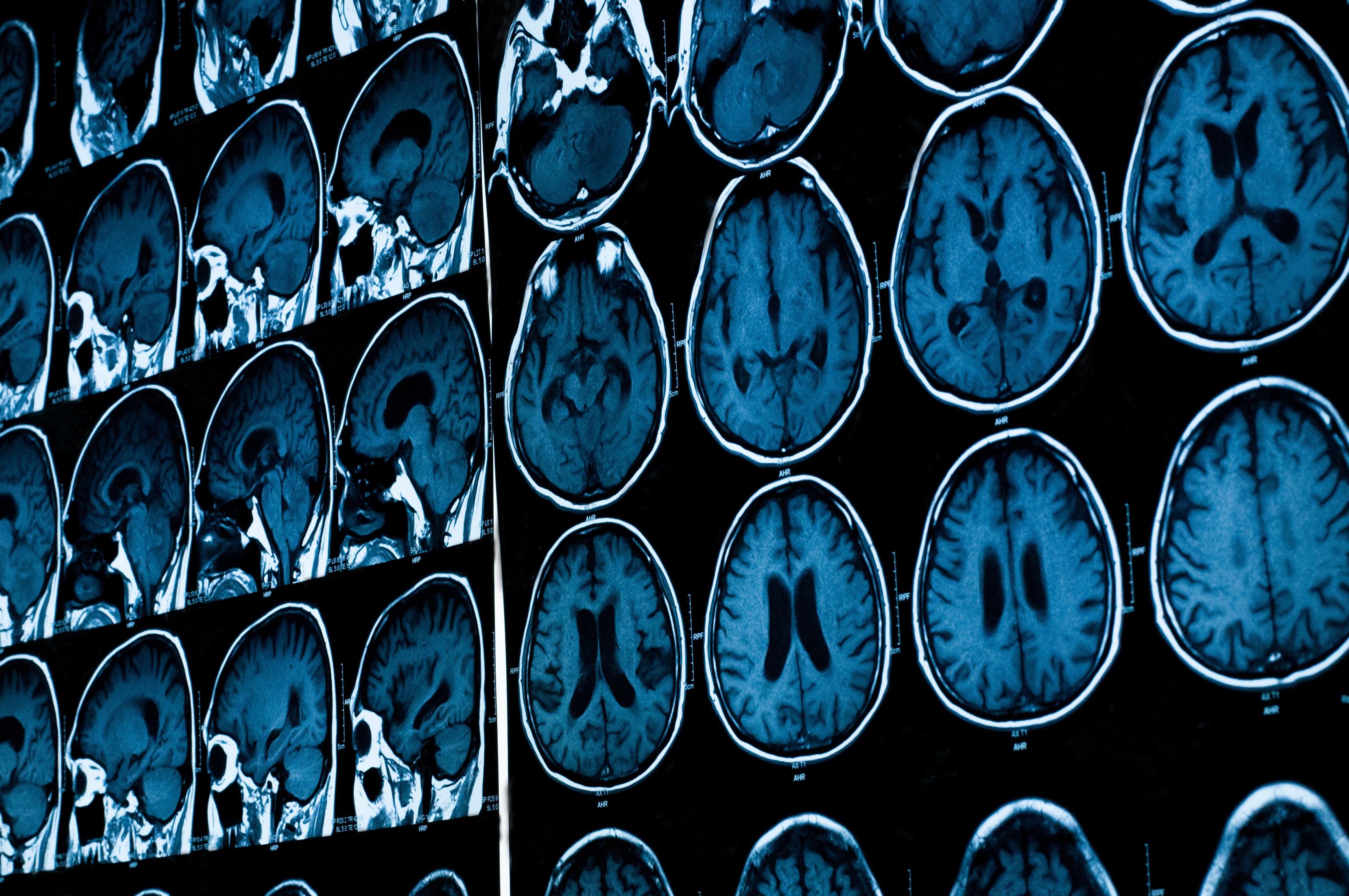 The Brain Center cover image