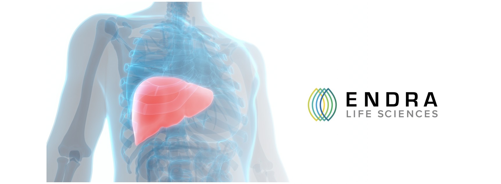 ENDRA Life Sciences (Nasdaq: NDRA) cover image